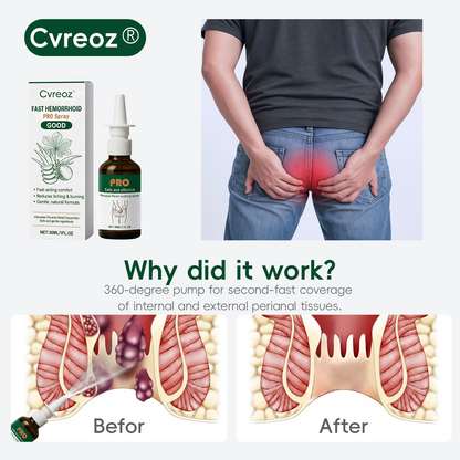 🎅 Božična razprodaja | Cvreoz® Fast Hemorrhoid PRO Spray