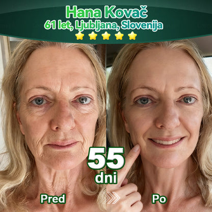 💥𝐿𝑜𝑡𝑚𝑎𝑦® 𝐾𝑎𝑝𝑙𝑗𝑖𝑐𝑒 𝑧 𝑚𝑎𝑡𝑖č𝑛𝑖𝑚𝑖 𝑐𝑒𝑙𝑖𝑐𝑎𝑚𝑖 𝑖𝑛 𝑘𝑜𝑙𝑎𝑔𝑒𝑛𝑠𝑘𝑖𝑚𝑖 𝑝𝑒𝑝𝑡𝑖𝑑𝑖(za učvrstitev in dvig povešene kože ter zmanjšanje nastanka gub)💦