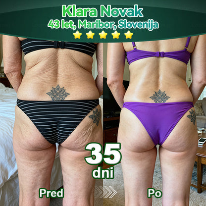 💥𝐿𝑜𝑡𝑚𝑎𝑦® 𝐾𝑎𝑝𝑙𝑗𝑖𝑐𝑒 𝑧 𝑚𝑎𝑡𝑖č𝑛𝑖𝑚𝑖 𝑐𝑒𝑙𝑖𝑐𝑎𝑚𝑖 𝑖𝑛 𝑘𝑜𝑙𝑎𝑔𝑒𝑛𝑠𝑘𝑖𝑚𝑖 𝑝𝑒𝑝𝑡𝑖𝑑𝑖(za učvrstitev in dvig povešene kože ter zmanjšanje nastanka gub)💦