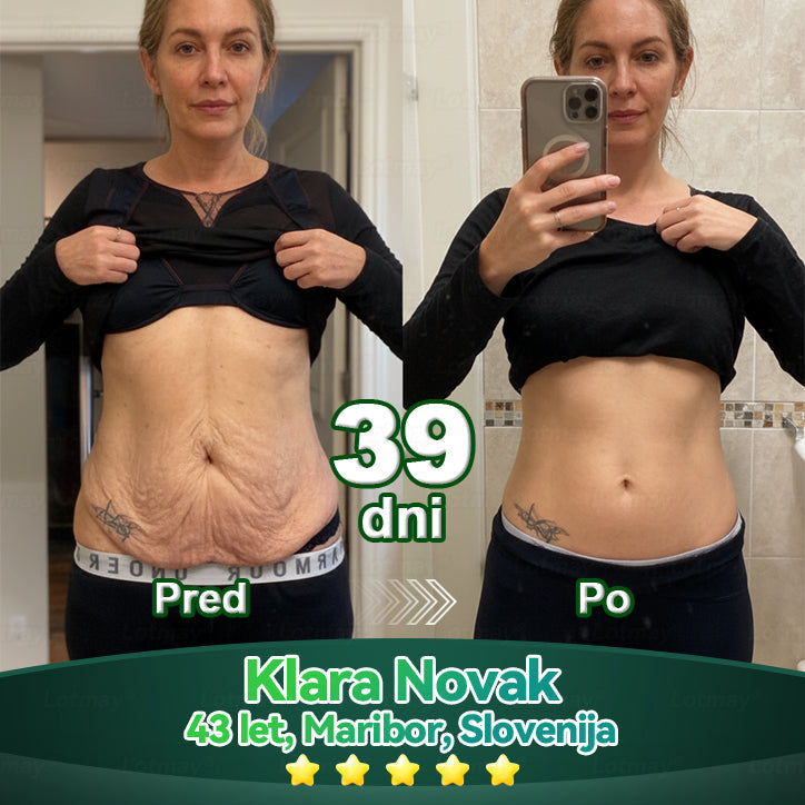 💥𝐿𝑜𝑡𝑚𝑎𝑦® 𝐾𝑎𝑝𝑙𝑗𝑖𝑐𝑒 𝑧 𝑚𝑎𝑡𝑖č𝑛𝑖𝑚𝑖 𝑐𝑒𝑙𝑖𝑐𝑎𝑚𝑖 𝑖𝑛 𝑘𝑜𝑙𝑎𝑔𝑒𝑛𝑠𝑘𝑖𝑚𝑖 𝑝𝑒𝑝𝑡𝑖𝑑𝑖(za učvrstitev in dvig povešene kože ter zmanjšanje nastanka gub)💦