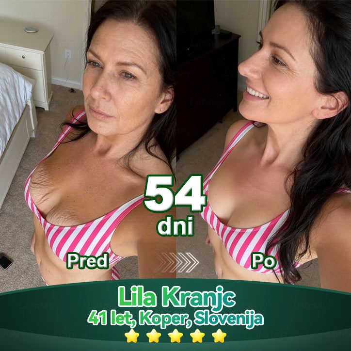 💥𝐿𝑜𝑡𝑚𝑎𝑦® 𝐾𝑎𝑝𝑙𝑗𝑖𝑐𝑒 𝑧 𝑚𝑎𝑡𝑖č𝑛𝑖𝑚𝑖 𝑐𝑒𝑙𝑖𝑐𝑎𝑚𝑖 𝑖𝑛 𝑘𝑜𝑙𝑎𝑔𝑒𝑛𝑠𝑘𝑖𝑚𝑖 𝑝𝑒𝑝𝑡𝑖𝑑𝑖(za učvrstitev in dvig povešene kože ter zmanjšanje nastanka gub)💦