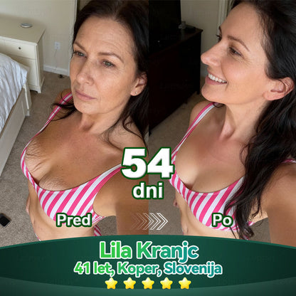 💥𝐿𝑜𝑡𝑚𝑎𝑦® 𝐾𝑎𝑝𝑙𝑗𝑖𝑐𝑒 𝑧 𝑚𝑎𝑡𝑖č𝑛𝑖𝑚𝑖 𝑐𝑒𝑙𝑖𝑐𝑎𝑚𝑖 𝑖𝑛 𝑘𝑜𝑙𝑎𝑔𝑒𝑛𝑠𝑘𝑖𝑚𝑖 𝑝𝑒𝑝𝑡𝑖𝑑𝑖(za učvrstitev in dvig povešene kože ter zmanjšanje nastanka gub)💦