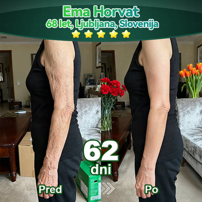 💥𝐿𝑜𝑡𝑚𝑎𝑦® 𝐾𝑎𝑝𝑙𝑗𝑖𝑐𝑒 𝑧 𝑚𝑎𝑡𝑖č𝑛𝑖𝑚𝑖 𝑐𝑒𝑙𝑖𝑐𝑎𝑚𝑖 𝑖𝑛 𝑘𝑜𝑙𝑎𝑔𝑒𝑛𝑠𝑘𝑖𝑚𝑖 𝑝𝑒𝑝𝑡𝑖𝑑𝑖(za učvrstitev in dvig povešene kože ter zmanjšanje nastanka gub)💦