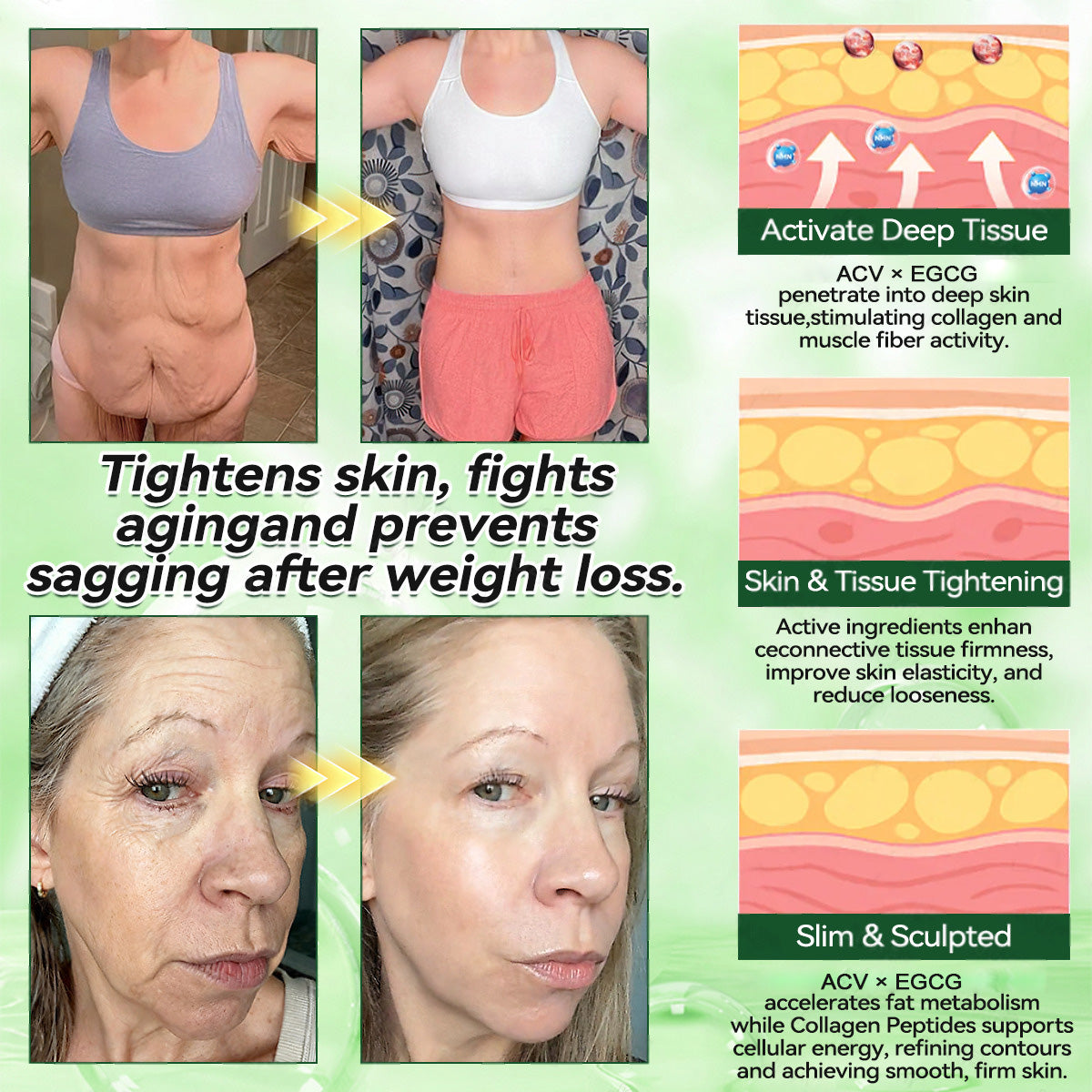 SI Health Online | Purelora® ACV × EGCG Dual-Action Herbal Wellness Drops (💧 Samo enkrat na dan, vidne spremembe že v 7 dneh)  ✅ Za debelost, ohlapno kožo, sladkorno bolezen, spalno apnejo, težave s sklepi in še več