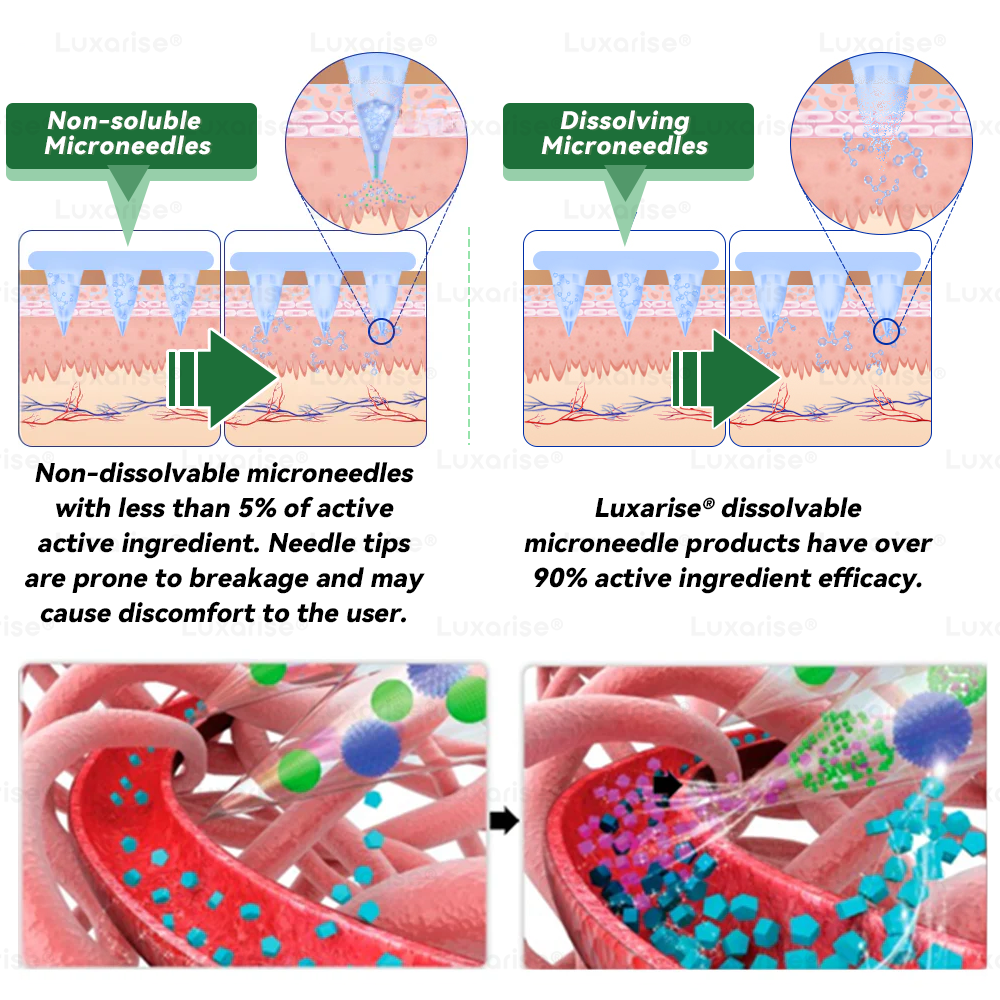Uradna trgovina | 👩‍⚕️Luxarise® Moringa & Berberine 10-v-1 napredni nano mikroiglični obliž (enkrat dnevno, vidne spremembe v 7 dneh) ✅Debelost, sladkorna bolezen, apneja v spanju in težave s sklepi🥦