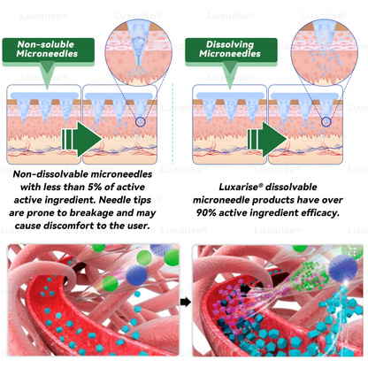 Uradna trgovina | 👩‍⚕️Luxarise® Moringa & Berberine 10-v-1 napredni nano mikroiglični obliž (enkrat dnevno, vidne spremembe v 7 dneh) ✅Debelost, sladkorna bolezen, apneja v spanju in težave s sklepi🥦