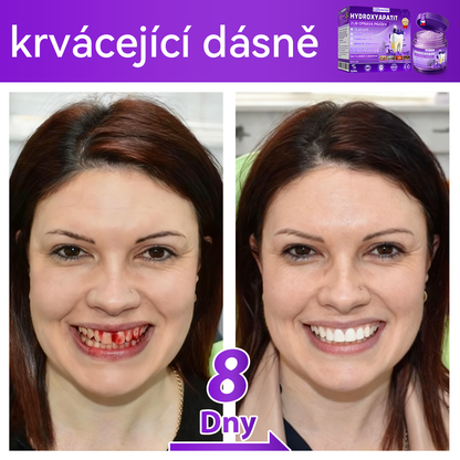 𝑂𝑓𝑖𝑐𝑖á𝑙𝑛í 𝑜𝑏𝑐ℎ𝑜𝑑 | 𝐷𝑜𝑟𝑚𝑜𝑟𝑛𝑎® 🔥𝐻𝑦𝑑𝑟𝑜𝑥𝑦𝑎𝑝𝑎𝑡𝑖𝑡 𝑍𝑢𝑏 𝑂𝑝𝑟𝑎𝑣𝑎 𝑃𝑟áš𝑒𝑘