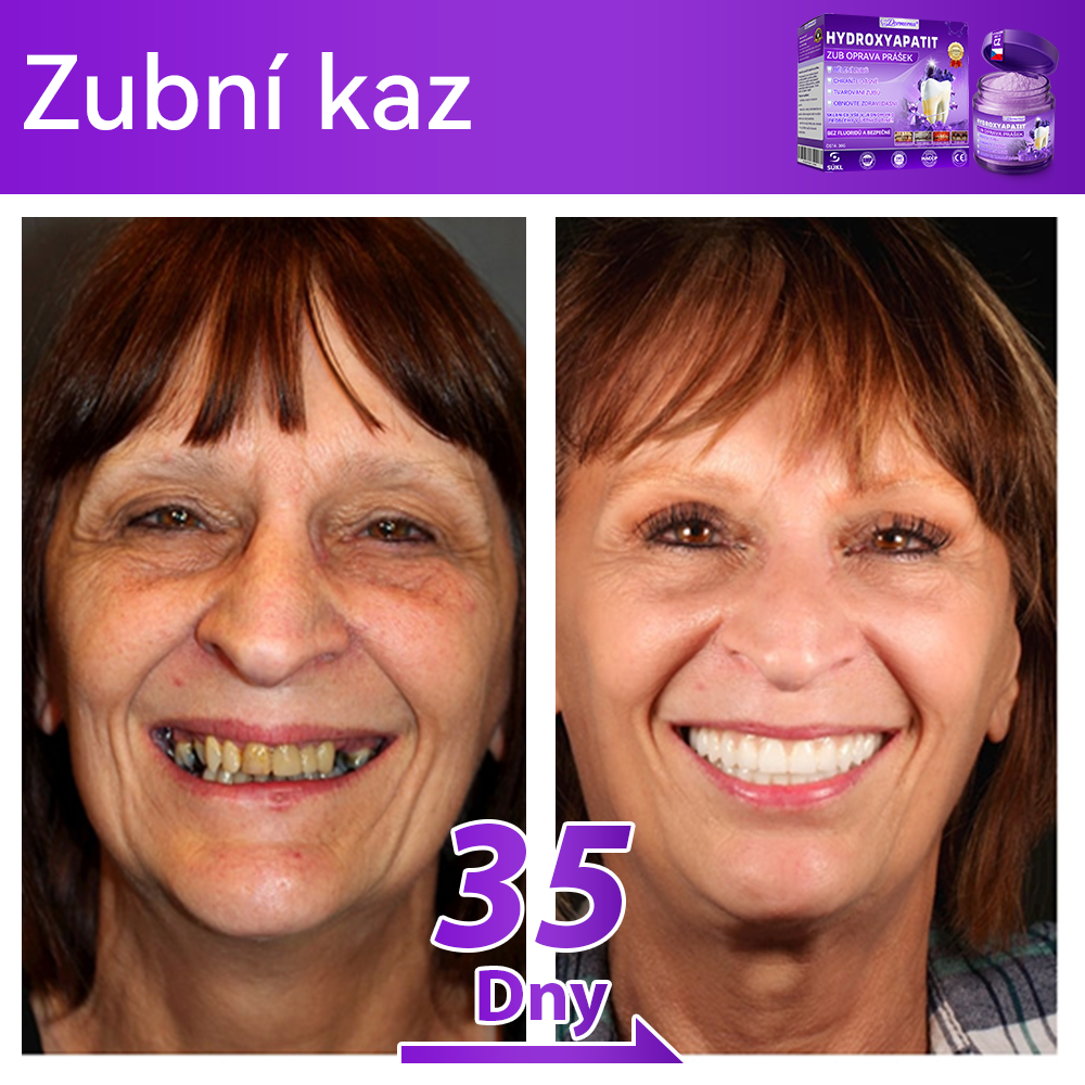 𝑂𝑓𝑖𝑐𝑖á𝑙𝑛í 𝑜𝑏𝑐ℎ𝑜𝑑 | 𝐷𝑜𝑟𝑚𝑜𝑟𝑛𝑎® 🔥𝐻𝑦𝑑𝑟𝑜𝑥𝑦𝑎𝑝𝑎𝑡𝑖𝑡 𝑍𝑢𝑏 𝑂𝑝𝑟𝑎𝑣𝑎 𝑃𝑟áš𝑒𝑘