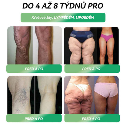🌿 Oficiální obchod ČR | STDEI® GLP-1 8-v-1 Fit & Vital Řešení (Jednou denně, viditelné změny za 7 dní) ✅ Obezita, kardiovaskulární zdraví, cukrovka, spánková apnoe, zdraví střev, problémy se klouby a další.