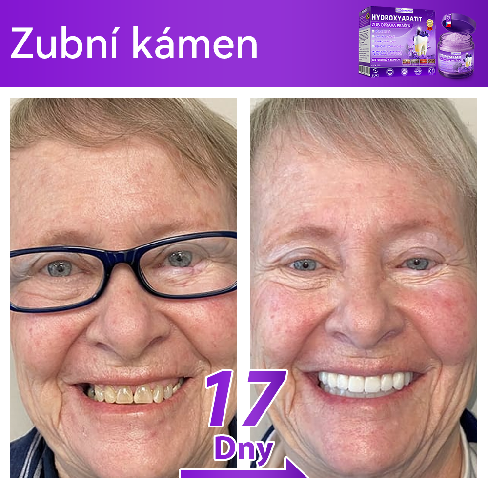 𝑂𝑓𝑖𝑐𝑖á𝑙𝑛í 𝑜𝑏𝑐ℎ𝑜𝑑 | 𝐷𝑜𝑟𝑚𝑜𝑟𝑛𝑎® 🔥𝐻𝑦𝑑𝑟𝑜𝑥𝑦𝑎𝑝𝑎𝑡𝑖𝑡 𝑍𝑢𝑏 𝑂𝑝𝑟𝑎𝑣𝑎 𝑃𝑟áš𝑒𝑘