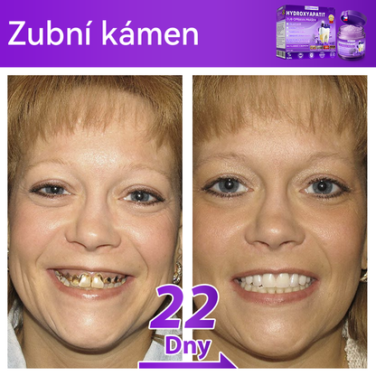 𝑂𝑓𝑖𝑐𝑖á𝑙𝑛í 𝑜𝑏𝑐ℎ𝑜𝑑 | 𝐷𝑜𝑟𝑚𝑜𝑟𝑛𝑎® 🔥𝐻𝑦𝑑𝑟𝑜𝑥𝑦𝑎𝑝𝑎𝑡𝑖𝑡 𝑍𝑢𝑏 𝑂𝑝𝑟𝑎𝑣𝑎 𝑃𝑟áš𝑒𝑘