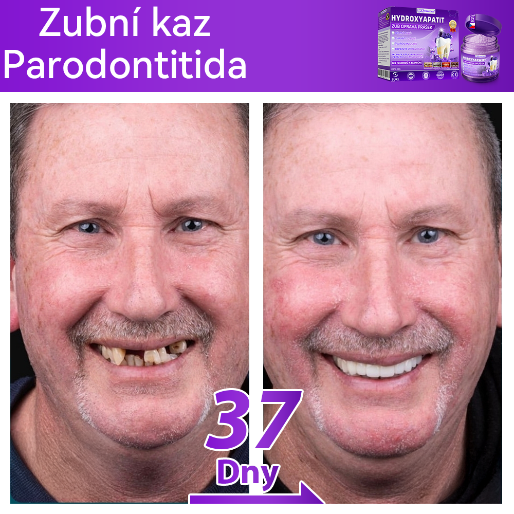 𝑂𝑓𝑖𝑐𝑖á𝑙𝑛í 𝑜𝑏𝑐ℎ𝑜𝑑 | 𝐷𝑜𝑟𝑚𝑜𝑟𝑛𝑎® 🔥𝐻𝑦𝑑𝑟𝑜𝑥𝑦𝑎𝑝𝑎𝑡𝑖𝑡 𝑍𝑢𝑏 𝑂𝑝𝑟𝑎𝑣𝑎 𝑃𝑟áš𝑒𝑘